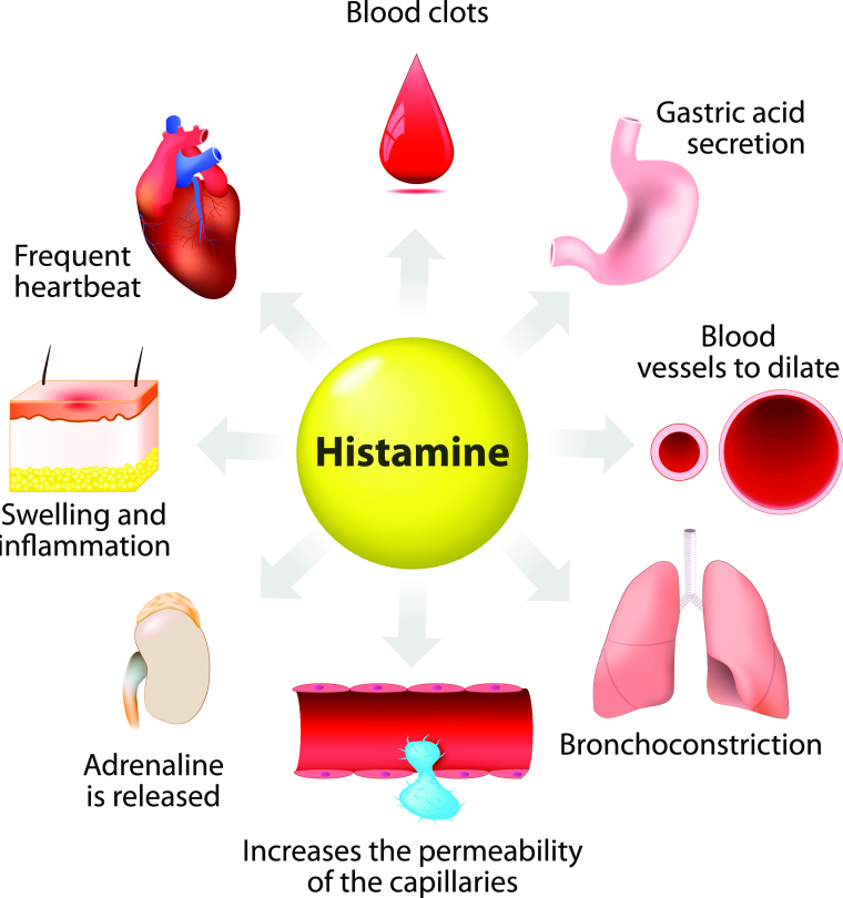 Probiotica en histamine-intolerantie_1860